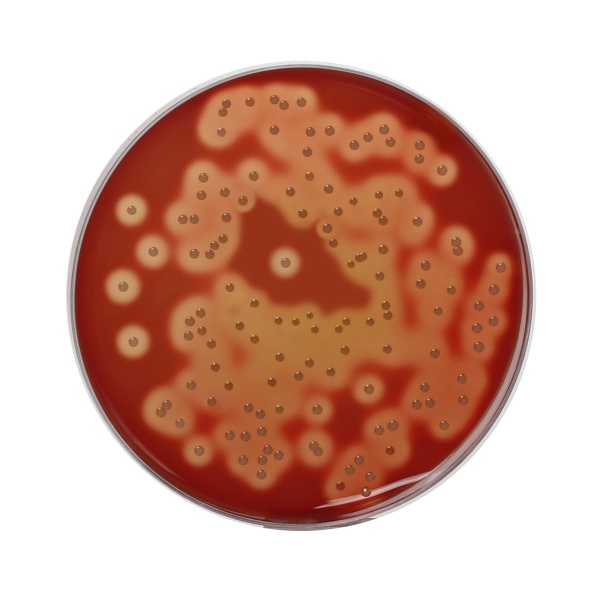 HiEncapâ„¢ Blood Agar Base (HiEncapâ„¢ Infusion Agar)